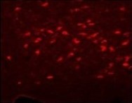 ChAT | choline O-acetyltransferase in the group Antibodies Human Cell Biology / Neuroscience / Neurodegenerative diseases / Alzheimer's disease at Agrisera AB (Antibodies for research) (AS13 2689)